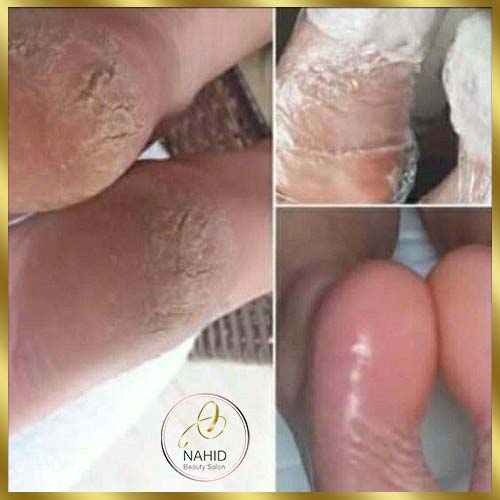 گالری پدیکور